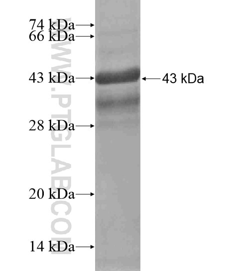 RASD1 fusion protein Ag18818 SDS-PAGE