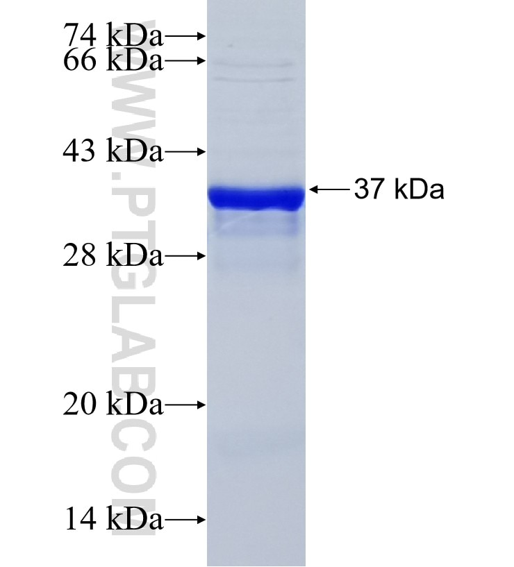 RASD2 fusion protein Ag25829 SDS-PAGE