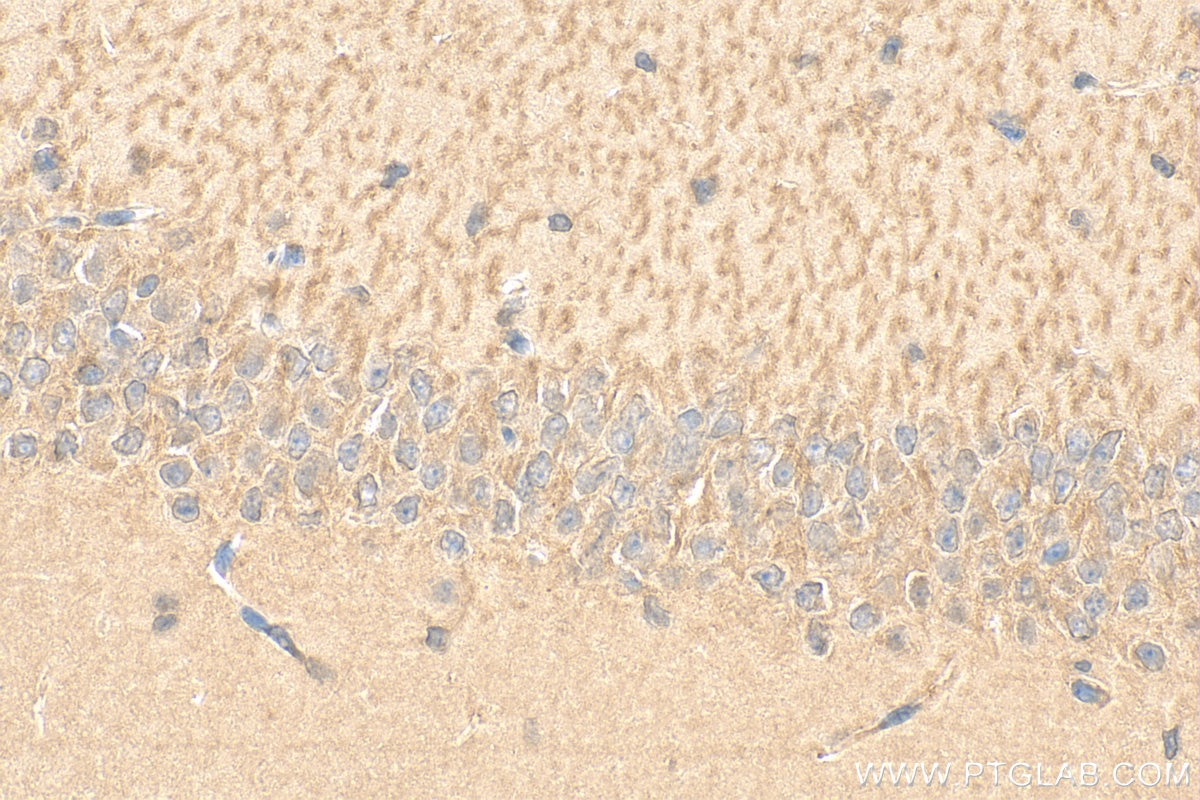 Immunohistochemistry (IHC) staining of mouse brain tissue using RASEF Polyclonal antibody (11569-1-AP)
