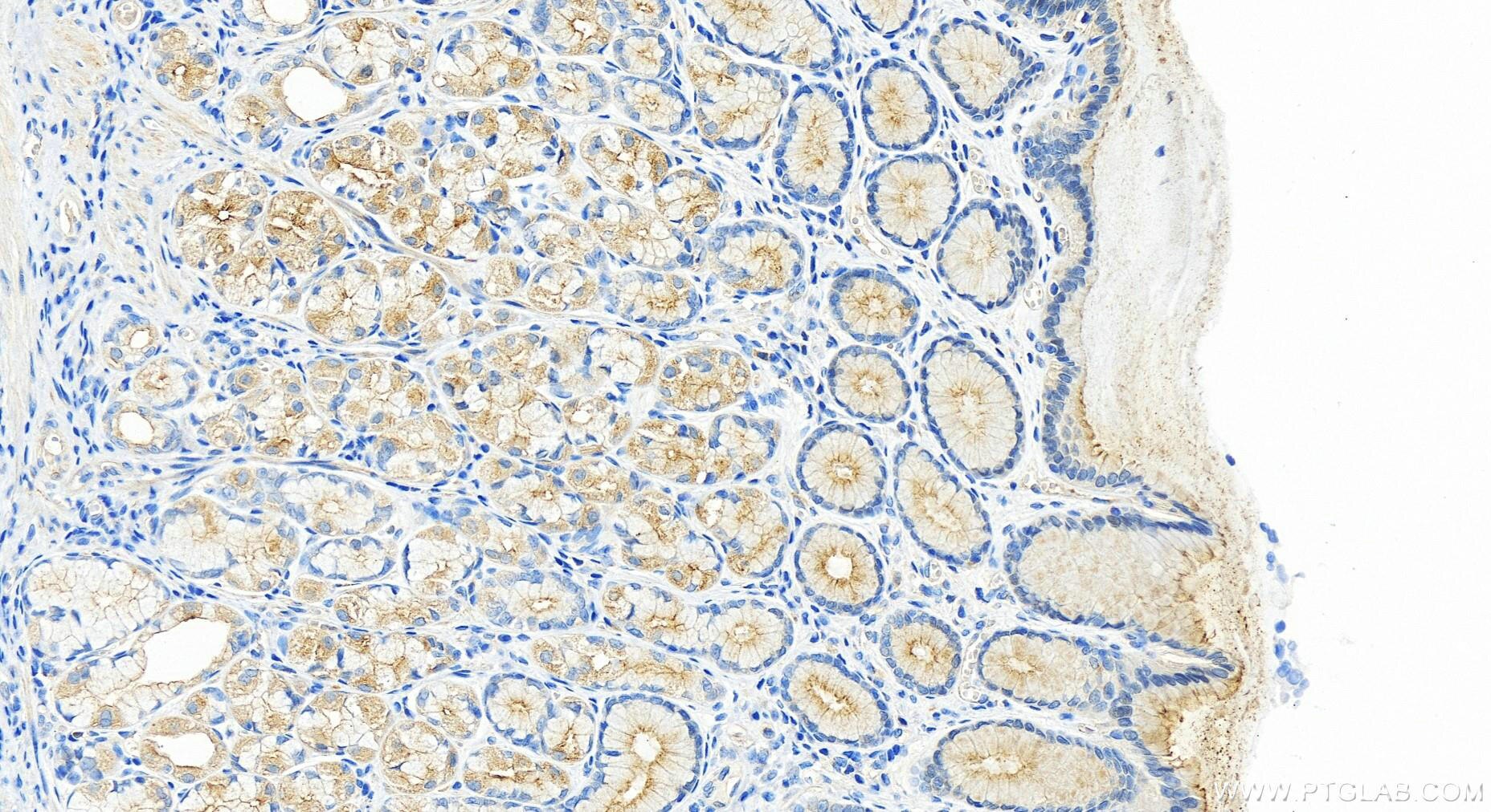 Immunohistochemistry (IHC) staining of human stomach tissue using RASEF Polyclonal antibody (28162-1-AP)