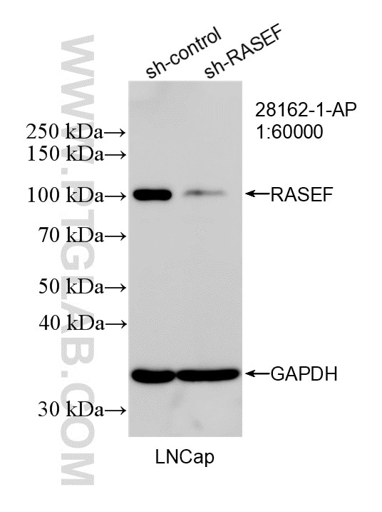 WB result of RASEF antibody (28162-1-AP; 1:60000; incubated at room temperature for 1.5 hours) with sh-Control and sh-RASEF transfected LNCaP cells. Western Blot (WB) analysis of LNCaP cells using RASEF Polyclonal antibody (28162-1-AP)