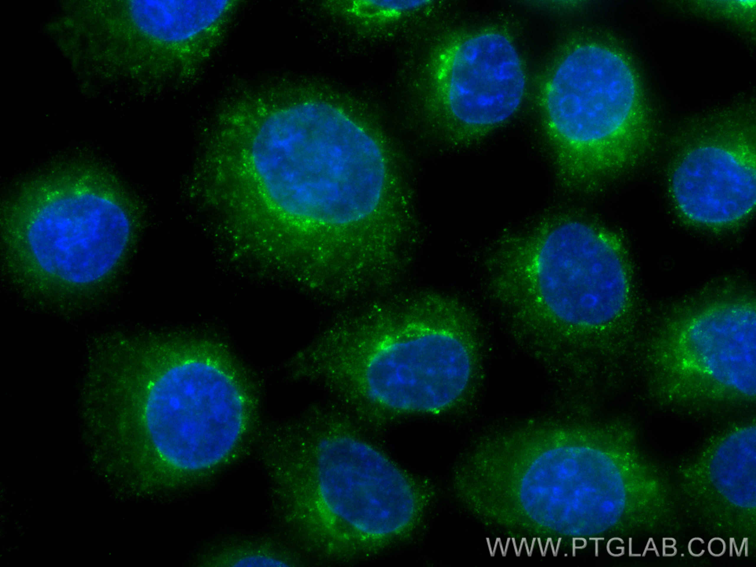 Immunofluorescence (IF) / fluorescent staining of A431 cells using RASEF Monoclonal antibody (67159-1-Ig)