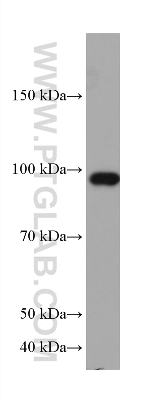Western Blot (WB) analysis of LNCaP cells using RASEF Monoclonal antibody (67159-1-Ig)