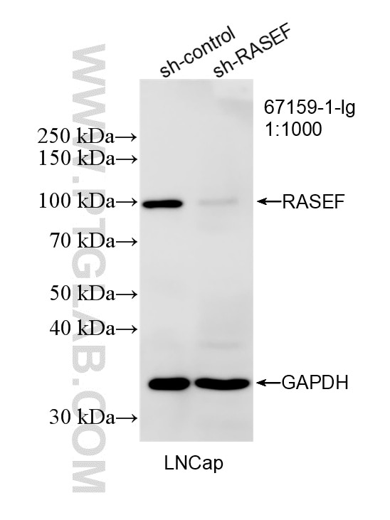 WB result of RASEF antibody (67159-1-Ig; 1:1000; incubated at room temperature for 1.5 hours) with sh-Control and sh-RASEF transfected LNCaP cells. Western Blot (WB) analysis of LNCaP cells using RASEF Monoclonal antibody (67159-1-Ig)