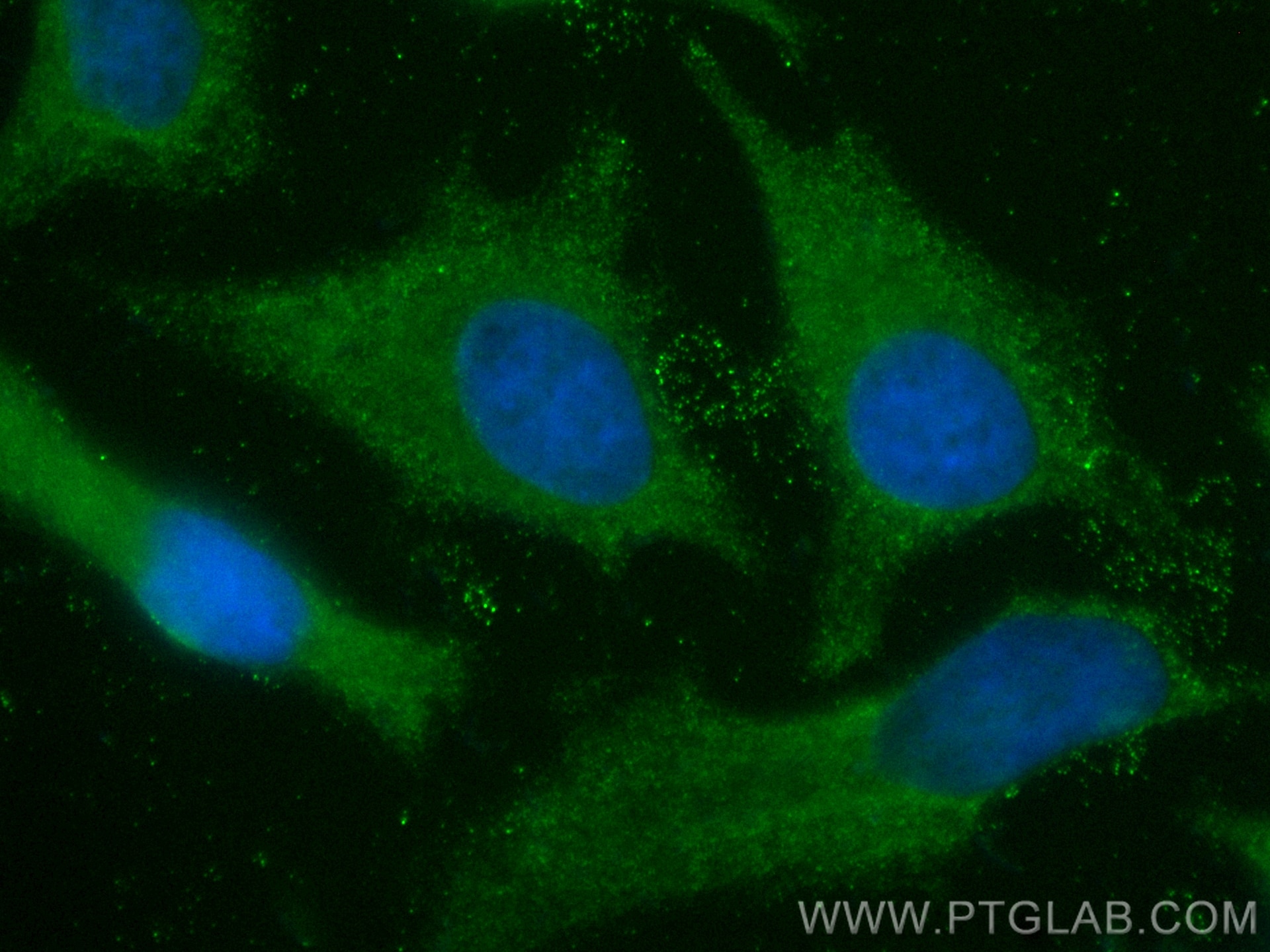 Immunofluorescence (IF) / fluorescent staining of HeLa cells using CoraLite® Plus 488-conjugated RASGAP Polyclonal an (CL488-12935)