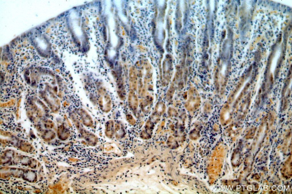 Immunohistochemistry (IHC) staining of human stomach tissue using RASGEF1B Polyclonal antibody (13617-1-AP)
