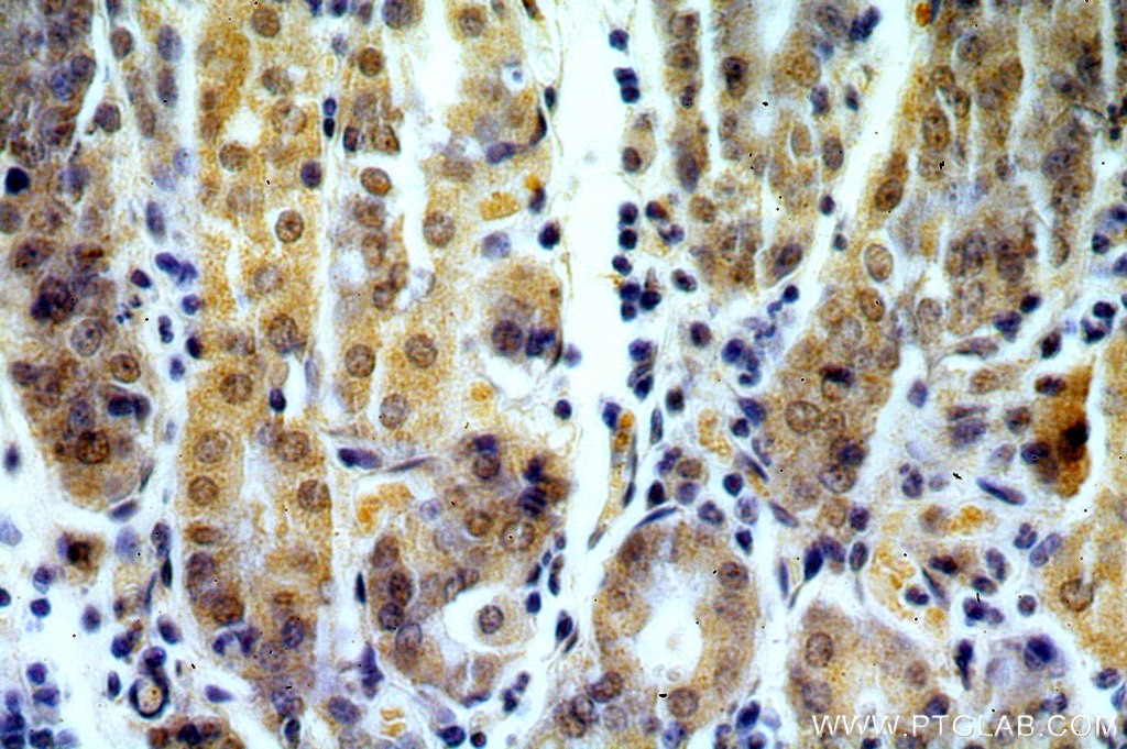 Immunohistochemistry (IHC) staining of human stomach tissue using RASGEF1B Polyclonal antibody (13617-1-AP)