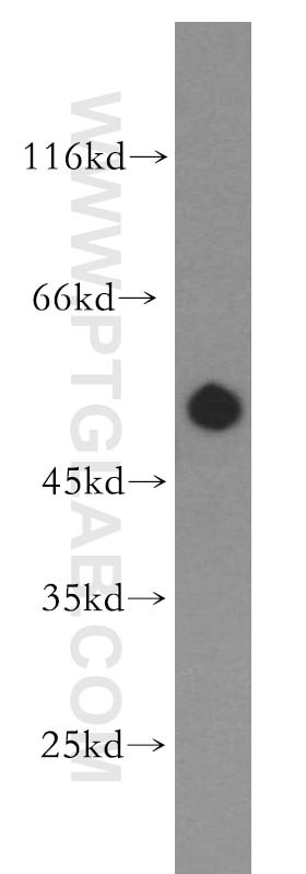 Western Blot (WB) analysis of human brain tissue using RASGEF1B Polyclonal antibody (13617-1-AP)