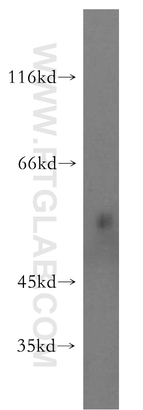 Western Blot (WB) analysis of mouse lung tissue using RASGEF1B Polyclonal antibody (13617-1-AP)