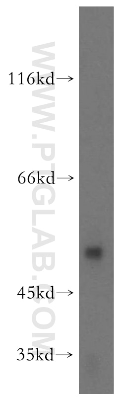 Western Blot (WB) analysis of mouse ovary tissue using RASGEF1B Polyclonal antibody (13617-1-AP)
