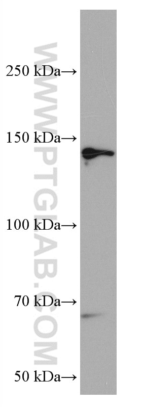 Western Blot (WB) analysis of pig brain tissue using RASGRF1 Monoclonal antibody (67010-1-Ig)