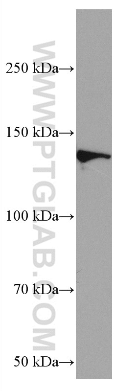 Western Blot (WB) analysis of rat brain tissue using RASGRF1 Monoclonal antibody (67010-1-Ig)