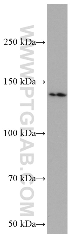 Western Blot (WB) analysis of rat cerebellum tissue using RASGRF1 Monoclonal antibody (67010-1-Ig)