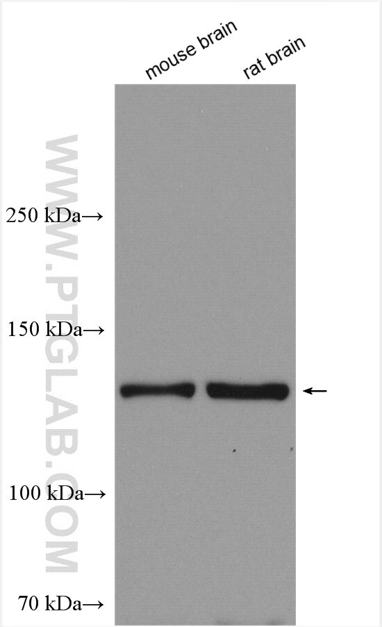 Western Blot (WB) analysis of various lysates using RASGRF2 Polyclonal antibody (26788-1-AP)