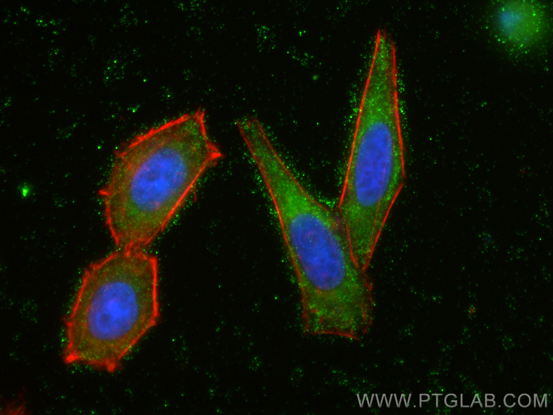 Immunofluorescence (IF) / fluorescent staining of HepG2 cells using RASGRP1 Polyclonal antibody (26997-1-AP)