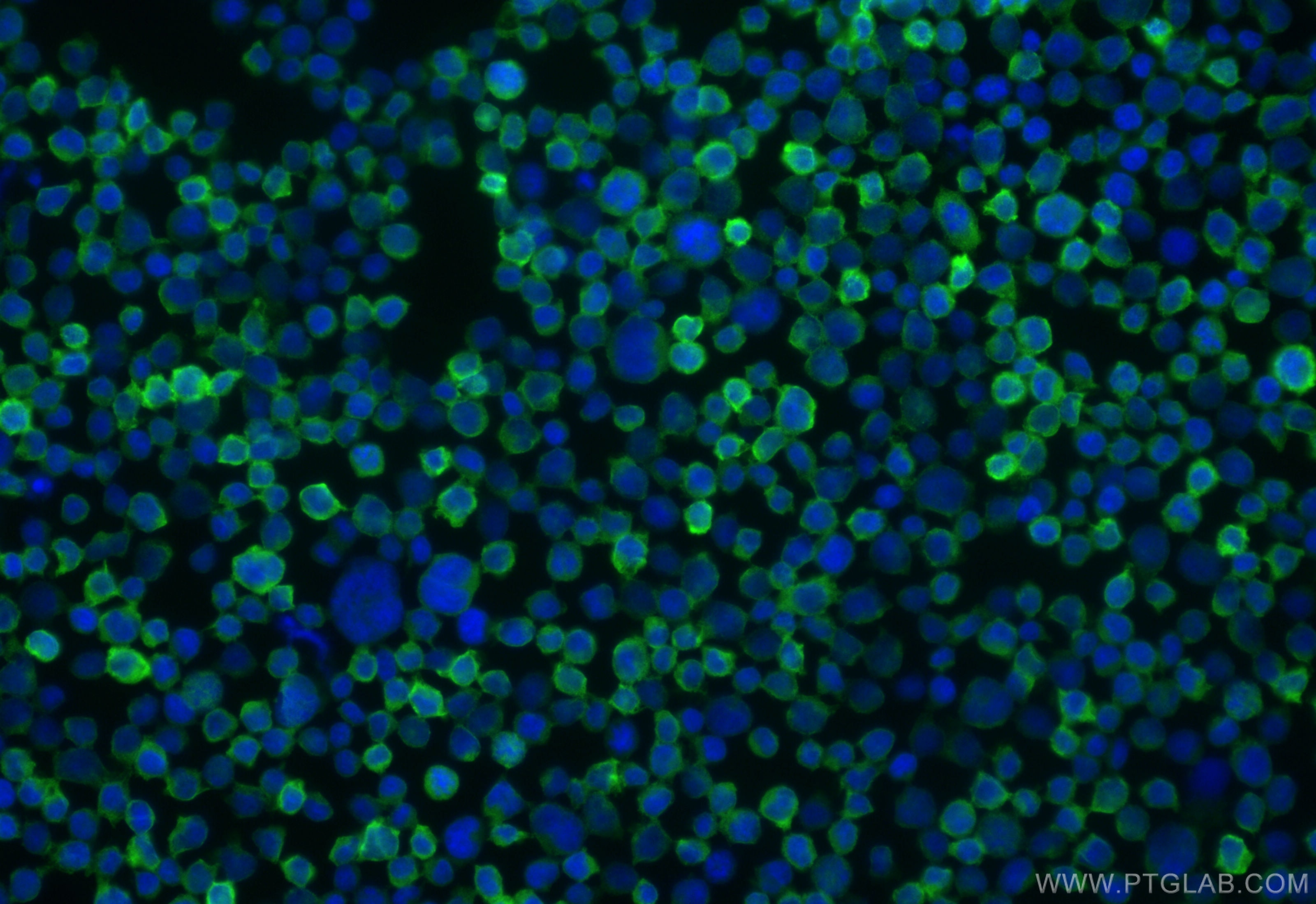 Immunofluorescence (IF) / fluorescent staining of Jurkat cells using RASGRP2 Polyclonal antibody (30189-1-AP)