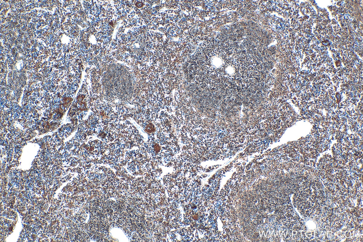 Immunohistochemistry (IHC) staining of mouse spleen tissue using RASGRP2 Polyclonal antibody (30189-1-AP)