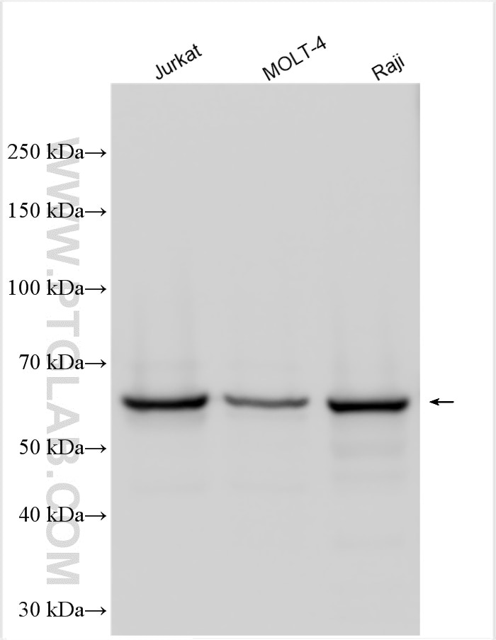 Western Blot (WB) analysis of various lysates using RASGRP2 Polyclonal antibody (30189-1-AP)