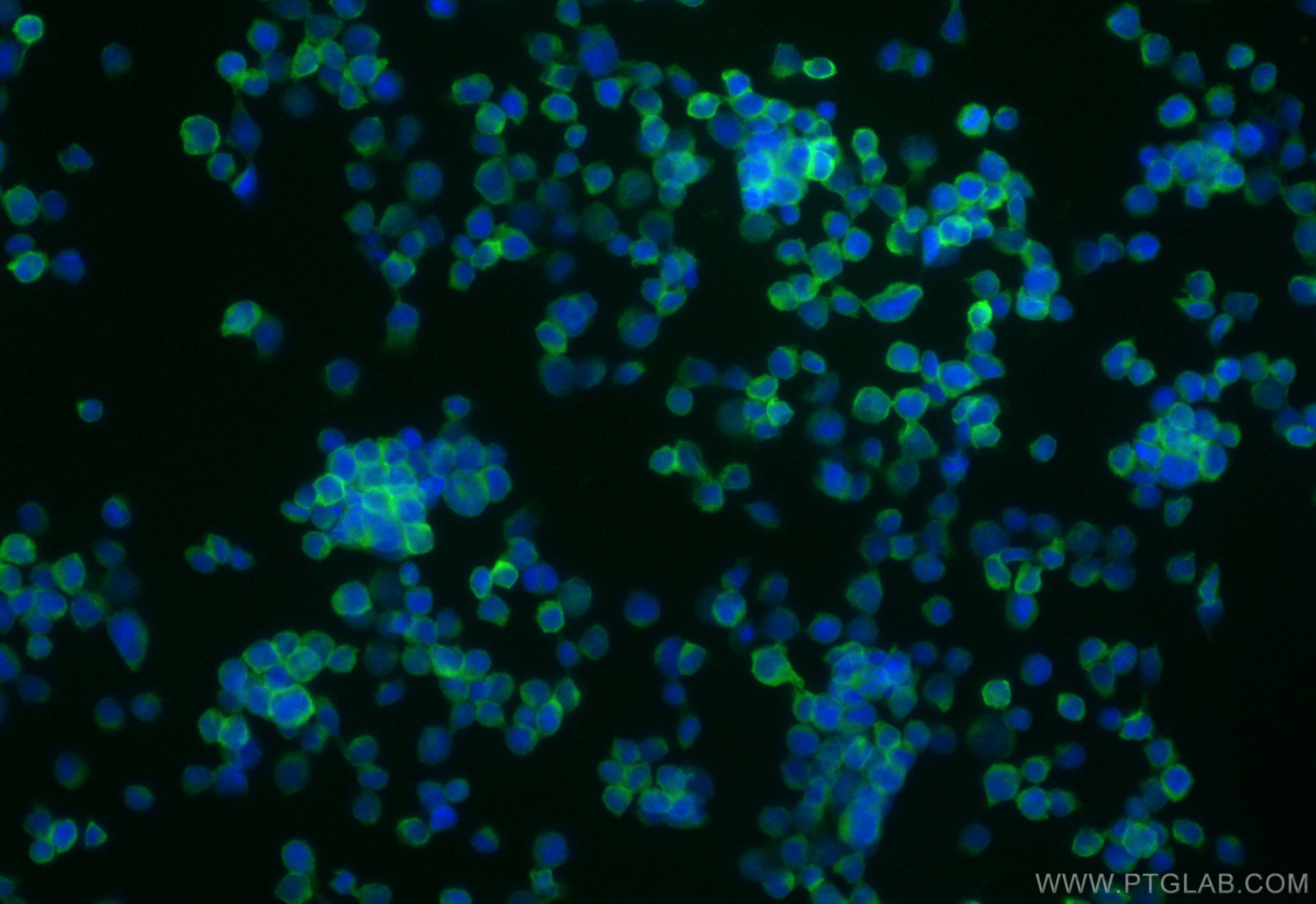 Immunofluorescence (IF) / fluorescent staining of Jurkat cells using CoraLite® Plus 488-conjugated RASGRP2 Polyclonal a (CL488-30189)