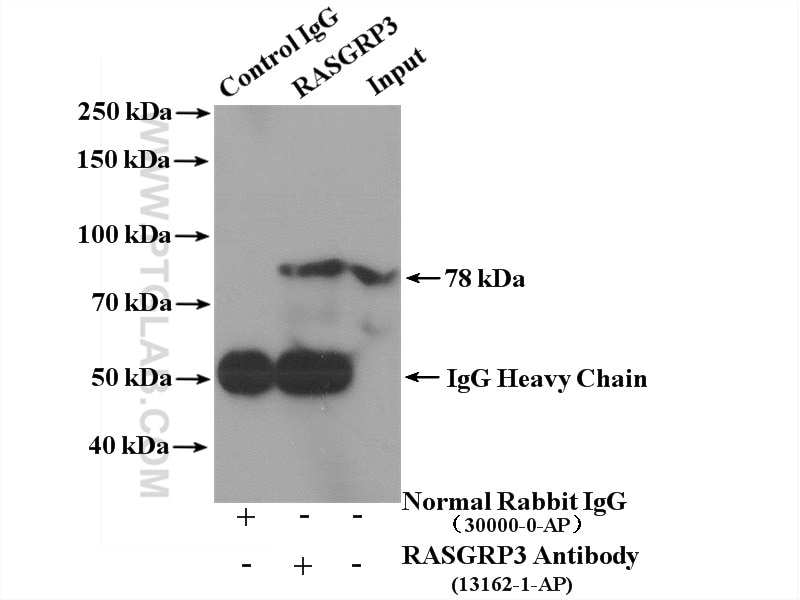 Immunoprecipitation (IP) experiment of RAW 264.7 cells using RASGRP3 Polyclonal antibody (13162-1-AP)