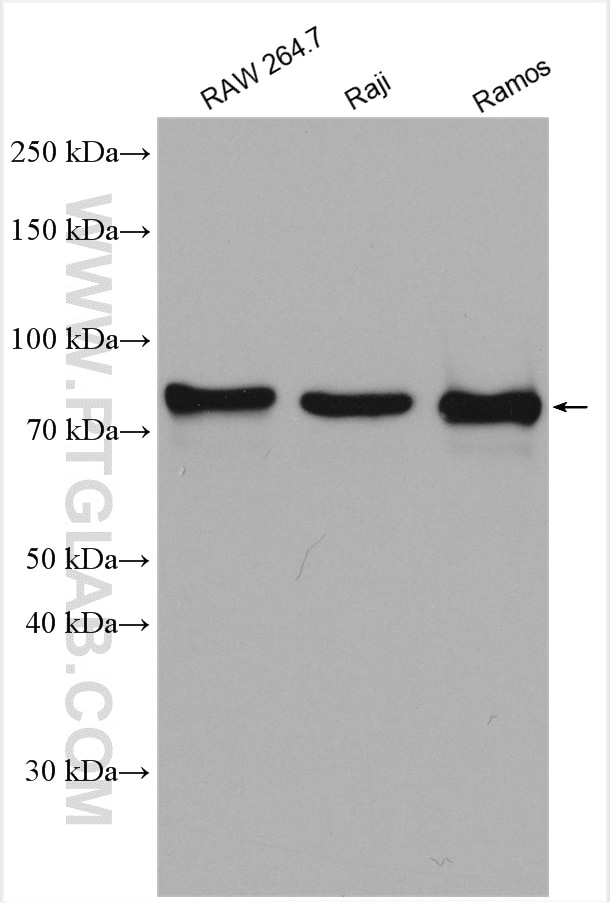 Western Blot (WB) analysis of various lysates using RASGRP3 Polyclonal antibody (13162-1-AP)