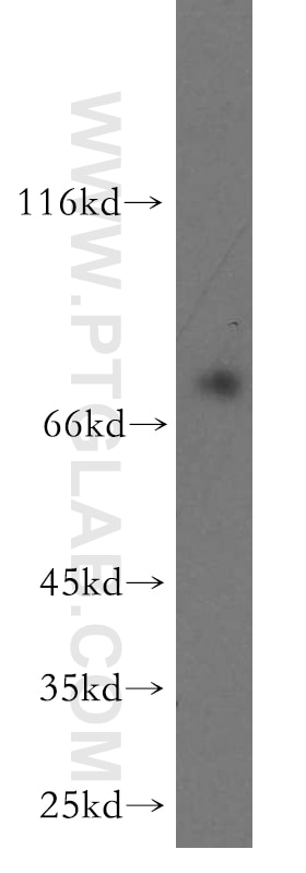 Western Blot (WB) analysis of PC-3 cells using RASGRP3 Polyclonal antibody (13162-1-AP)