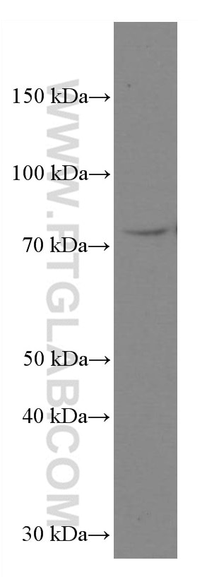Western Blot (WB) analysis of Jurkat cells using RASGRP3 Monoclonal antibody (66650-1-Ig)