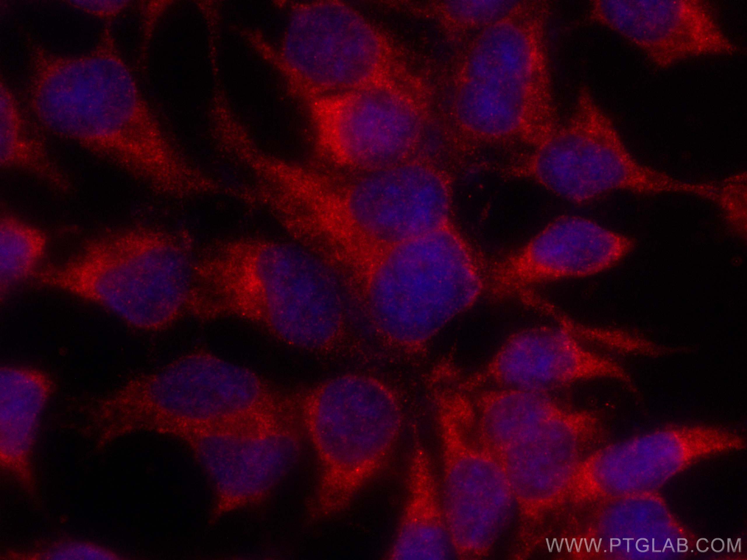 Immunofluorescence (IF) / fluorescent staining of HEK-293 cells using CoraLite®594-conjugated RASGRP3 Monoclonal antibod (CL594-66650)