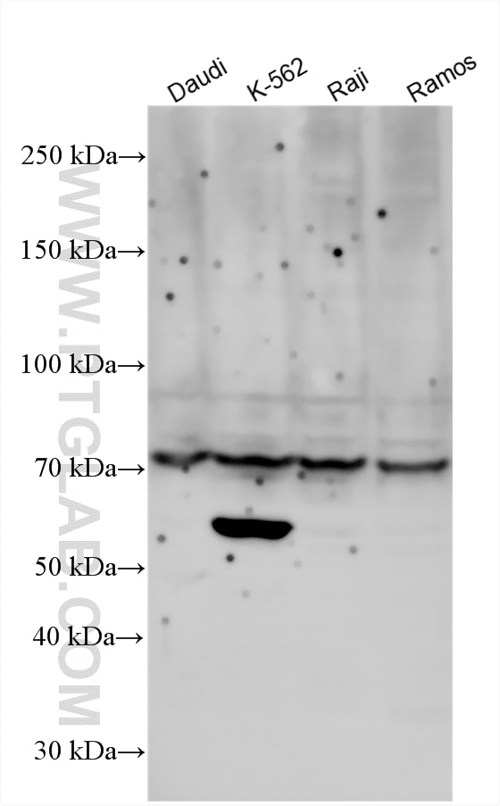 WB analysis using 29510-1-AP Western Blot (WB) analysis of various lysates using RASGRP4 Polyclonal antibody (29510-1-AP)