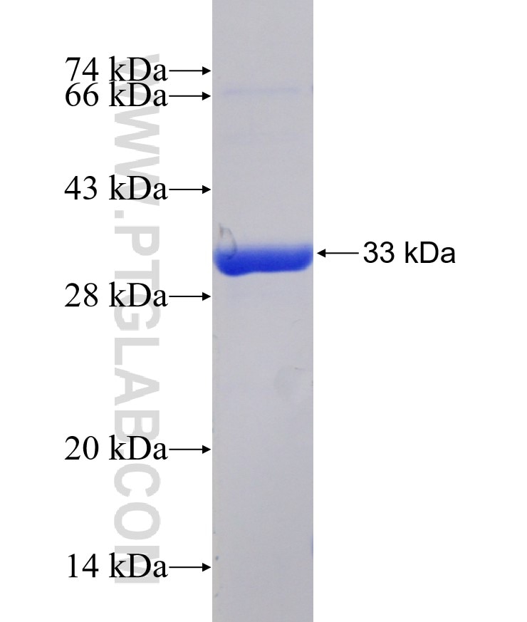 RASGRP4 fusion protein Ag31219 SDS-PAGE