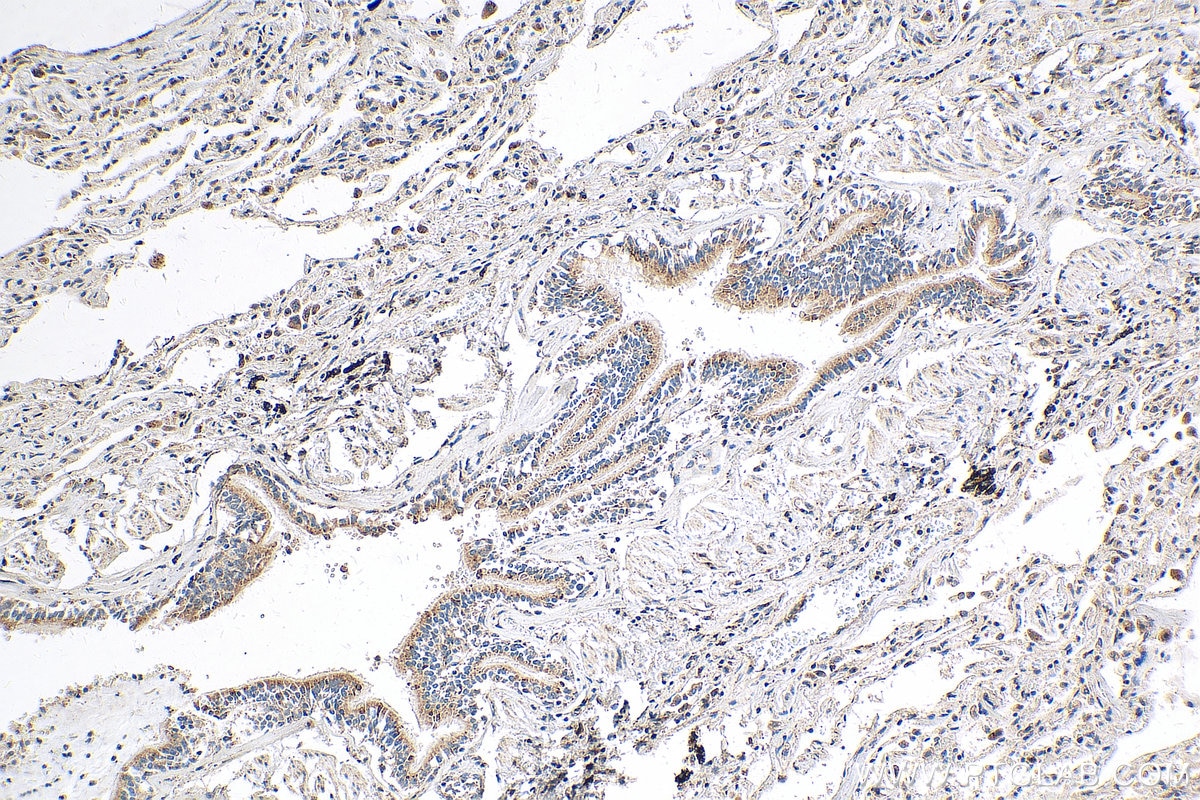 Immunohistochemistry (IHC) staining of human lung tissue using RASIP1 Polyclonal antibody (17971-1-AP)