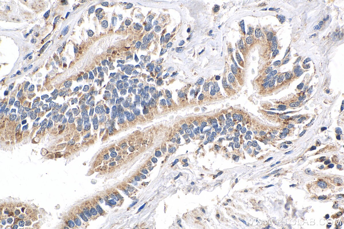 Immunohistochemistry (IHC) staining of human lung tissue using RASIP1 Polyclonal antibody (17971-1-AP)