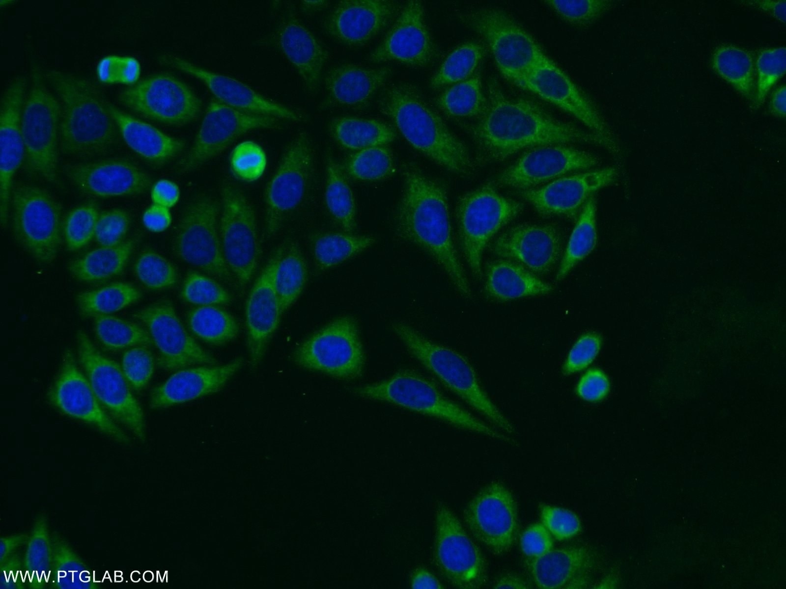 Immunofluorescence (IF) / fluorescent staining of HepG2 cells using RASIP1 Polyclonal antibody (26064-1-AP)