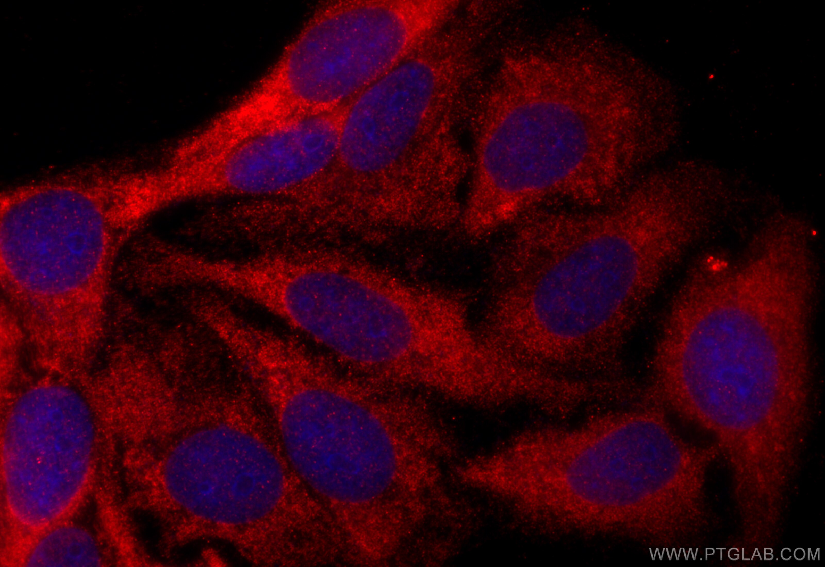 Immunofluorescence (IF) / fluorescent staining of HepG2 cells using RASIP1 Polyclonal antibody (26064-1-AP)