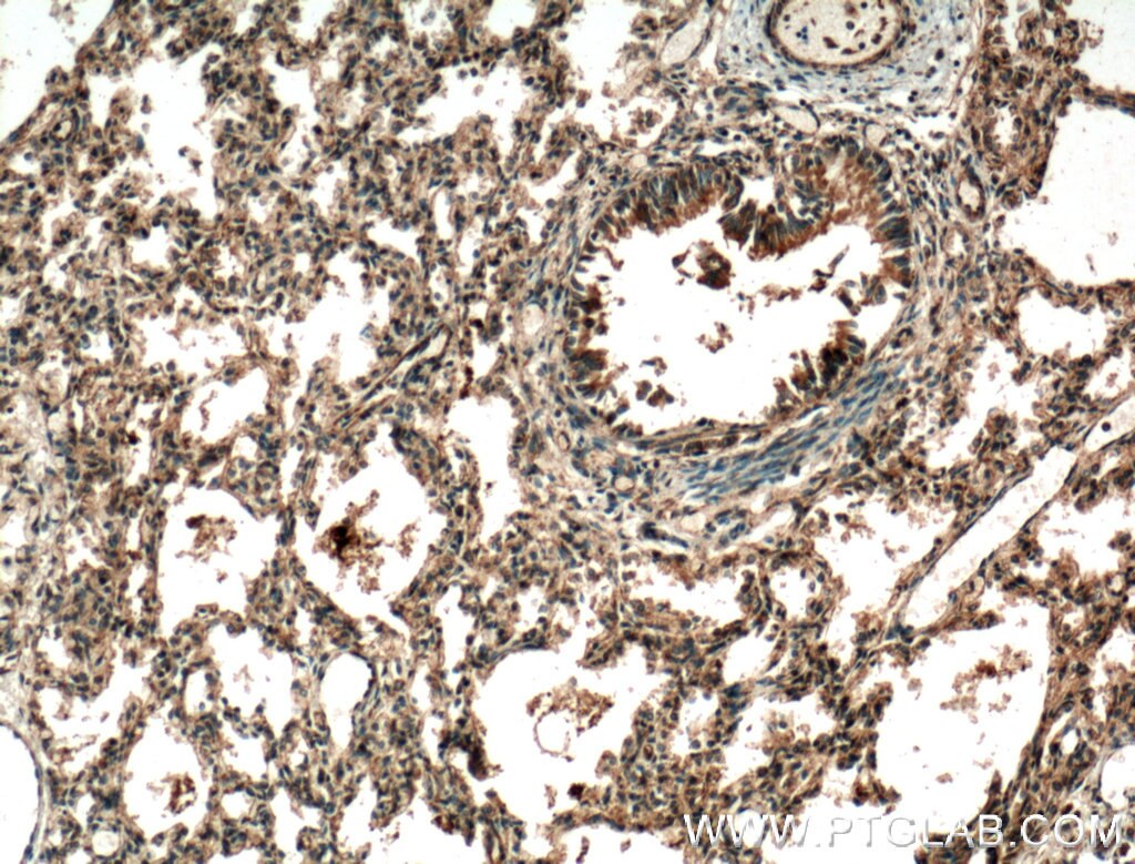 Immunohistochemistry (IHC) staining of human lung tissue using RASIP1 Polyclonal antibody (26064-1-AP)