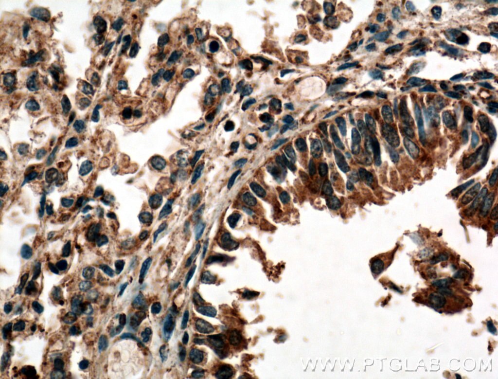 IHC staining of human lung using 26064-1-AP