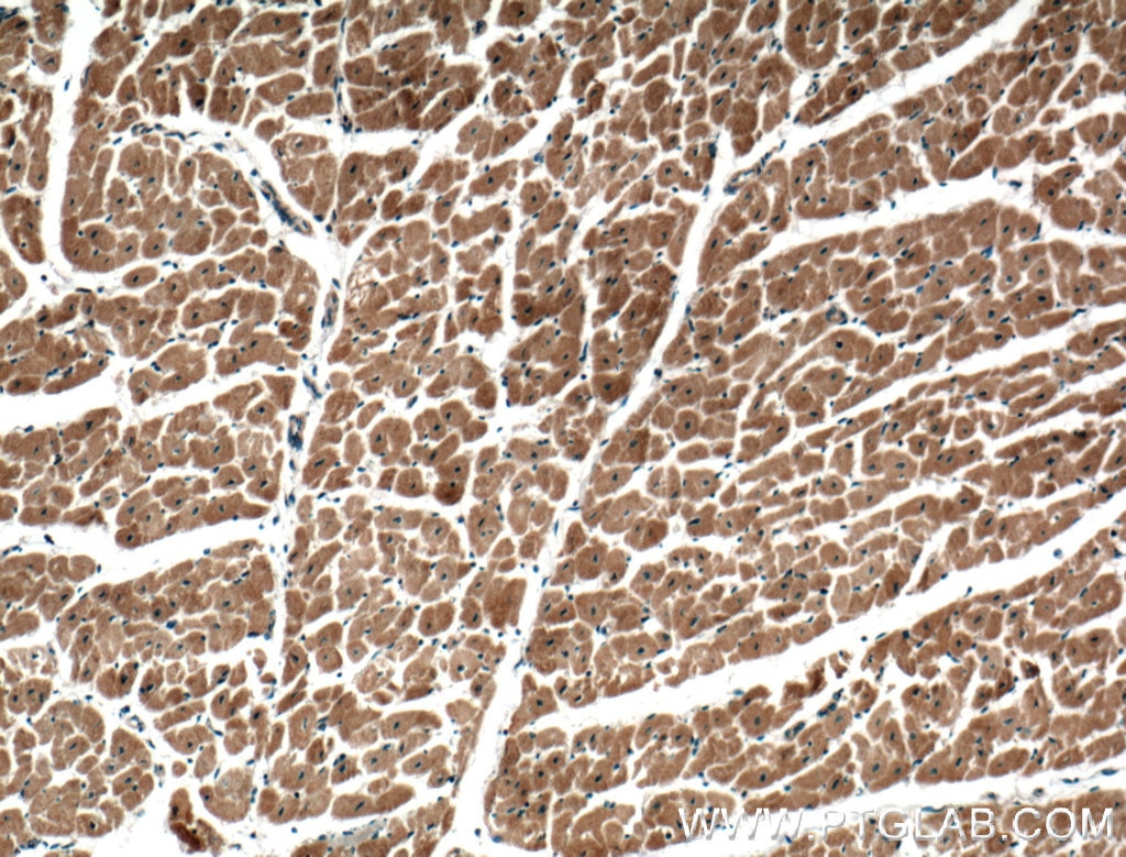 Immunohistochemistry (IHC) staining of human heart tissue using RASIP1 Polyclonal antibody (26064-1-AP)