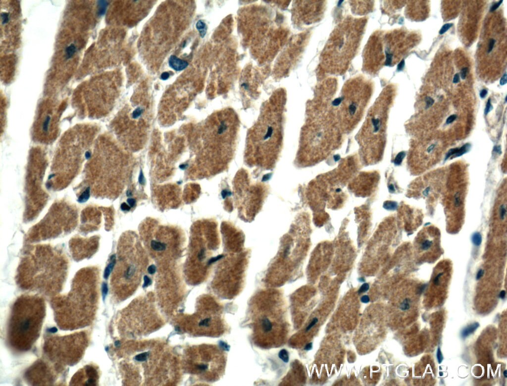 Immunohistochemistry (IHC) staining of human heart tissue using RASIP1 Polyclonal antibody (26064-1-AP)