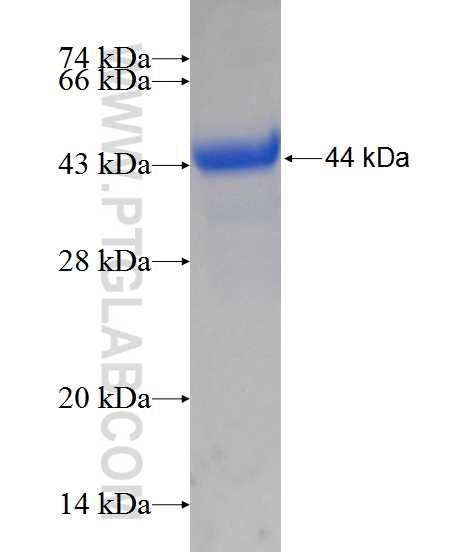 RASIP1 fusion protein Ag11982 SDS-PAGE
