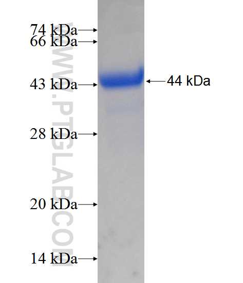 RASIP1 fusion protein Ag11982 SDS-PAGE