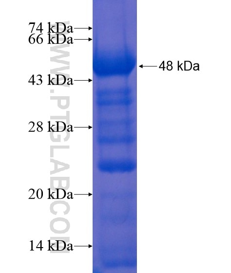 RASIP1 fusion protein Ag22036 SDS-PAGE