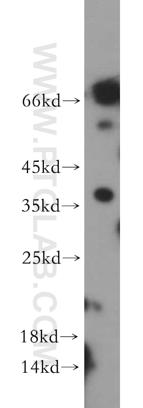 Western Blot (WB) analysis of HEK-293 cells using RASSF1 Polyclonal antibody (21219-1-AP)