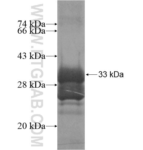 RASSF1 fusion protein Ag15652 SDS-PAGE