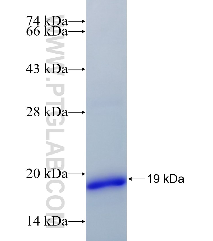 RASSF2 fusion protein Ag34707 SDS-PAGE RASSF2 fusion protein Ag34707 SDS-PAGE