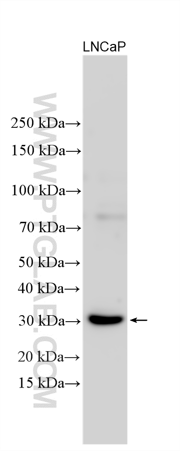LNCaP cells were subjected to SDS PAGE followed by western blot with 26428-1-AP (RASSF3 antibody) at dilution of 1:800 incubated at room temperature for 1.5 hours. Western Blot (WB) analysis of various lysates using RASSF3 Polyclonal antibody (26428-1-AP)