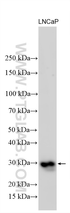 LNCaP cells were subjected to SDS PAGE followed by western blot with 26428-1-AP (RASSF3 antibody) at dilution of 1:1000 incubated at room temperature for 1.5 hours. Western Blot (WB) analysis of various lysates using RASSF3 Polyclonal antibody (26428-1-AP)