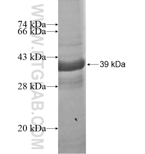RASSF3 fusion protein Ag15801 SDS-PAGE