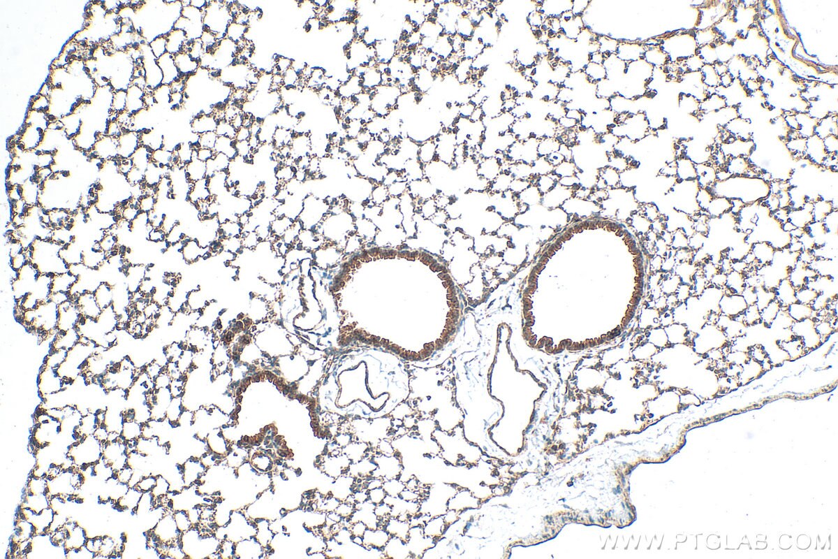 Immunohistochemistry (IHC) staining of mouse lung tissue using RASSF4 Polyclonal antibody (19118-1-AP)