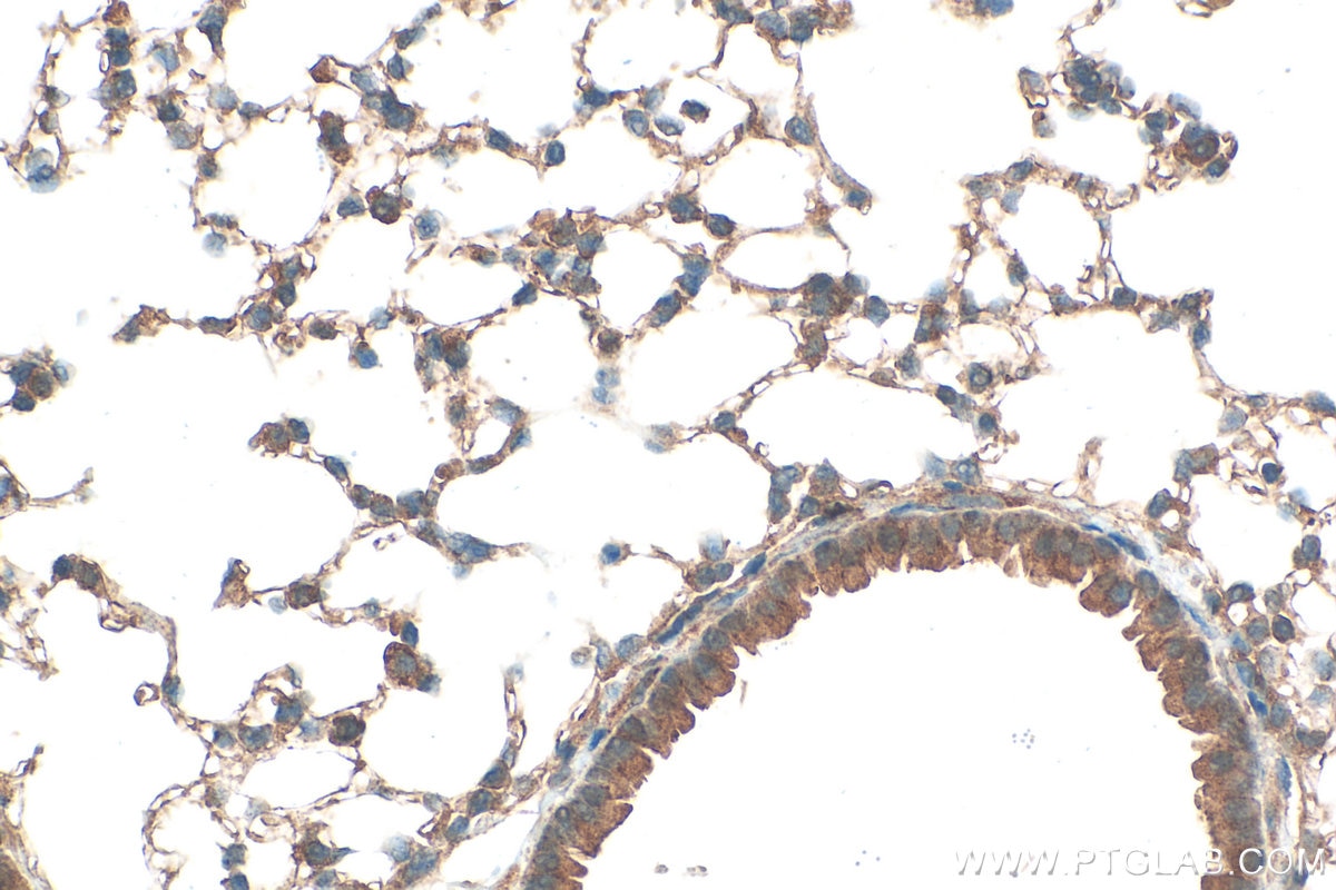Immunohistochemistry (IHC) staining of mouse lung tissue using RASSF4 Polyclonal antibody (19118-1-AP)