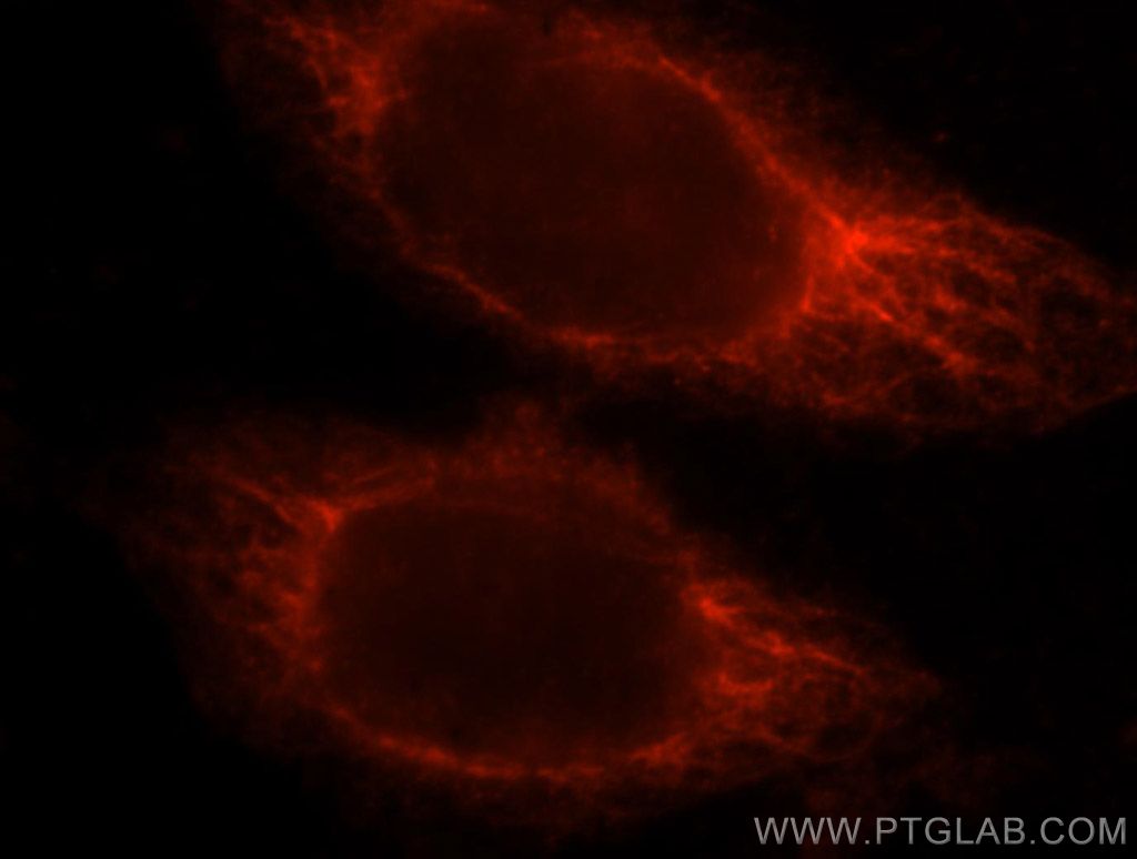 Immunofluorescence (IF) / fluorescent staining of HeLa cells using RASSF6 Polyclonal antibody (11921-1-AP)